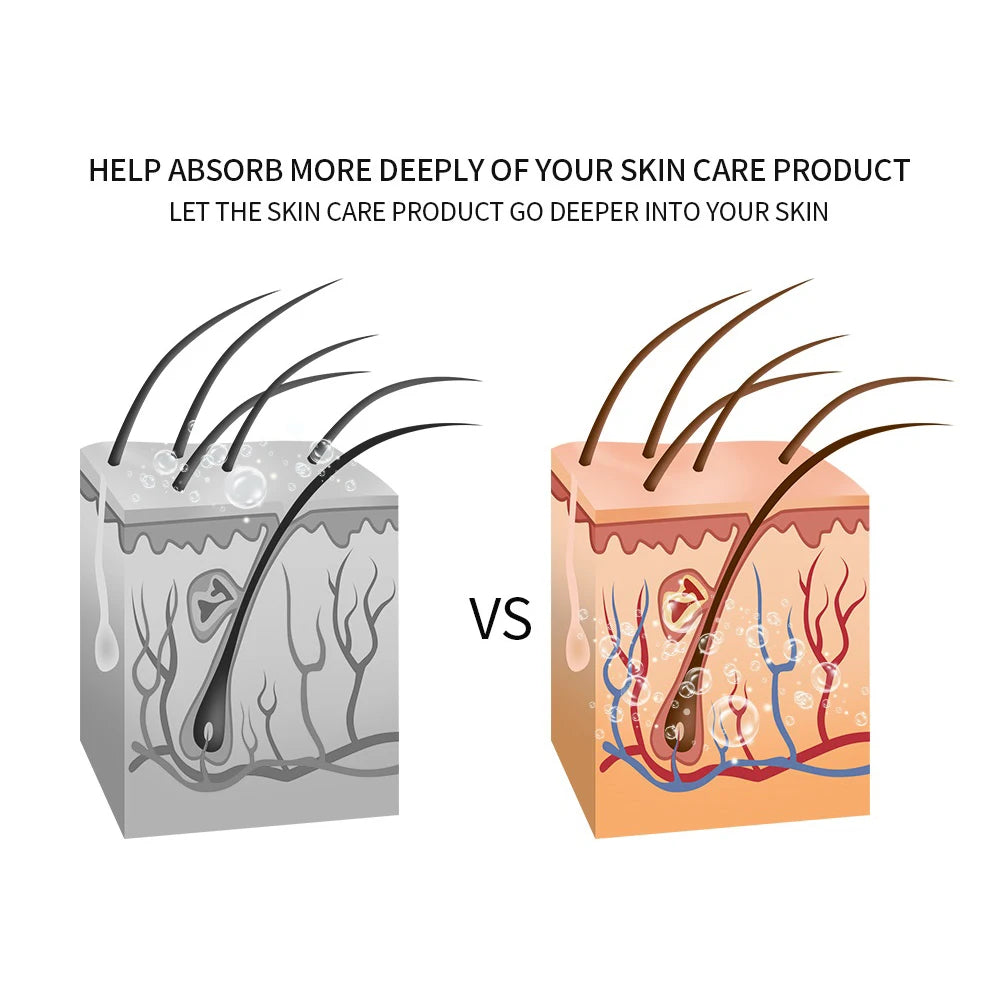 5 In 1 Home Facial Beauty Device Mesotherapy Electroporation RF Radio Frequency Facial LED Photon Skin Care Beauty Device Face Lifting Tighten - Curl and Collar