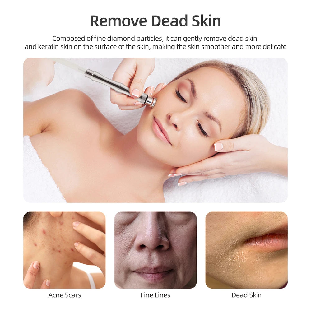 Spa Facial Peeling Deep Cleansing Device Face Beauty Machine Pore Deep Cleaning Skin Care - Curl and Collar