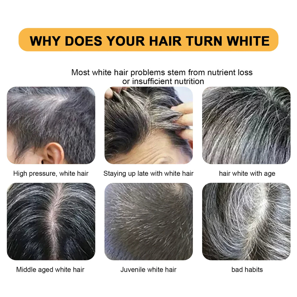 Jaysuing Hair Soap For Scalp Cleansing,Repair Damaged Hair Improve Hair Toughness and Promote Hair Growth Hair Shampoo Soap - Curl and Collar
