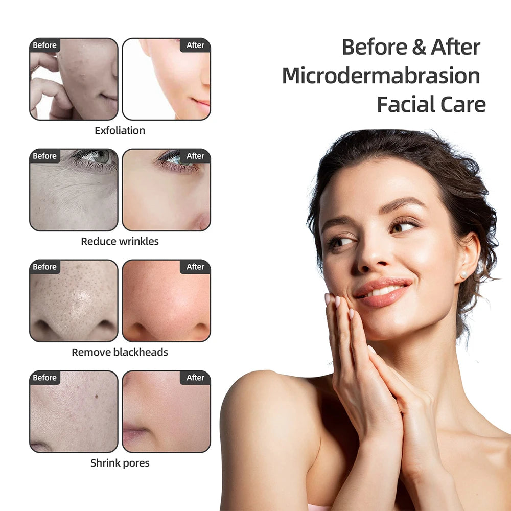 Spa Facial Peeling Deep Cleansing Device Face Beauty Machine Pore Deep Cleaning Skin Care - Curl and Collar