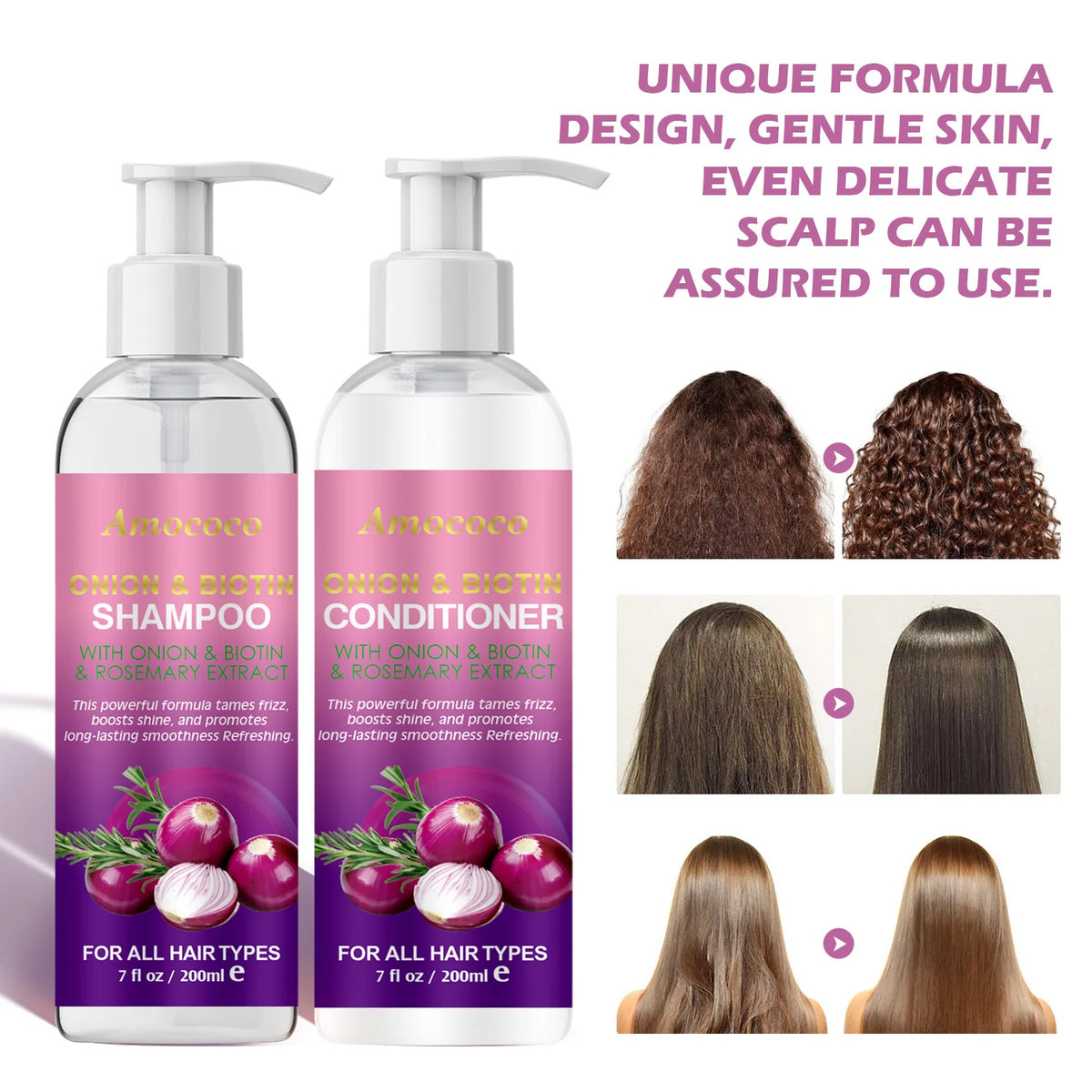 Amococo 2pcs X 200ml Shampoo and Conditioner Set with Onion Biotin Rosemary Hair Care Duo for All Hair Types Frizz Control Shine Boosting Sulfate Free - Curl and Collar